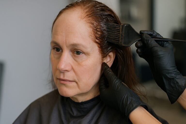 Peut on faire une coloration quand on perd ses cheveux